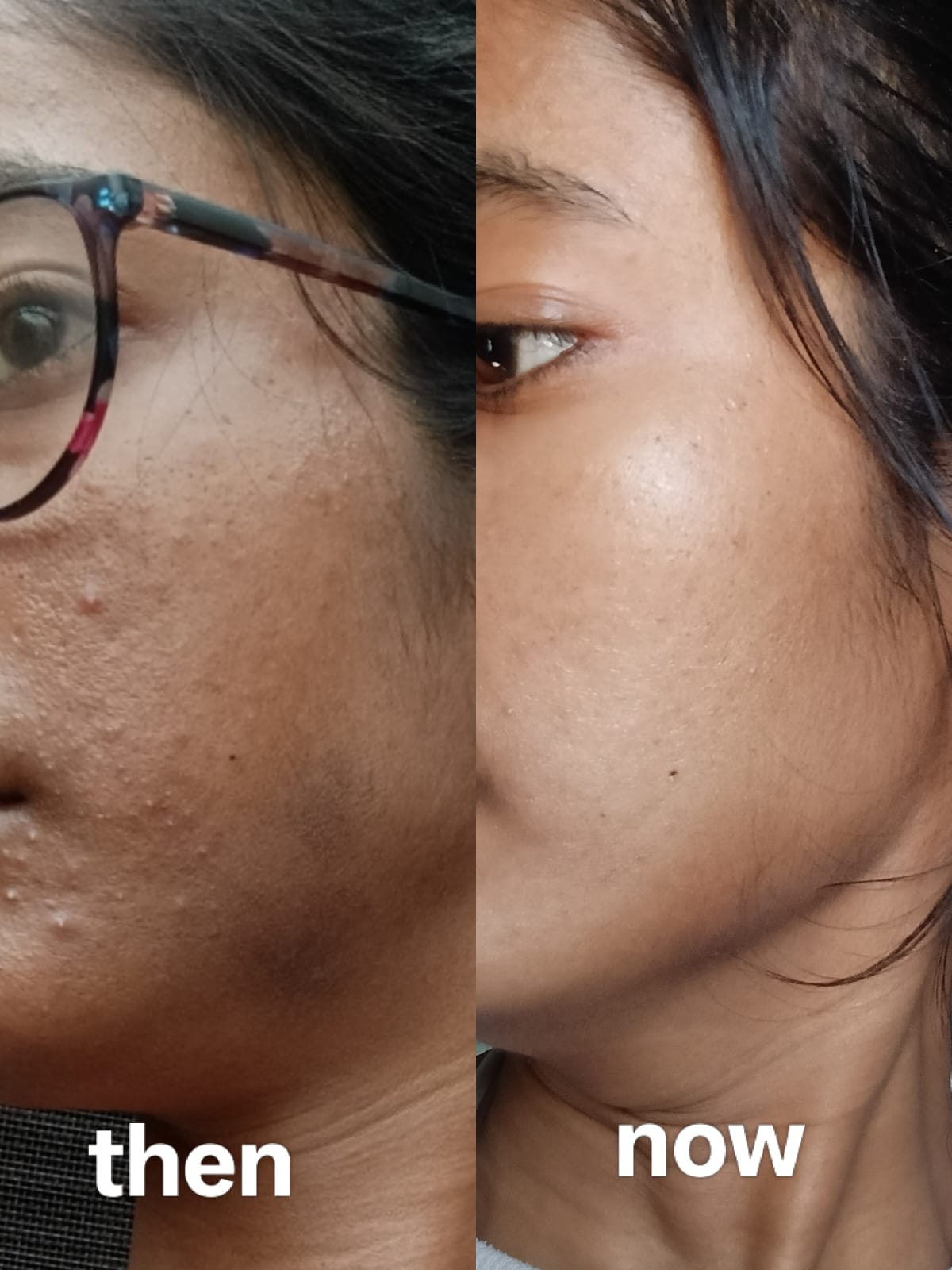 Harman Kaur - Before & After Result
